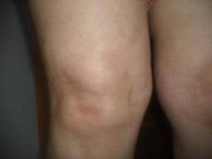 knees