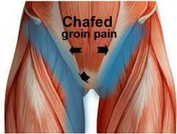 chafed and painful groin